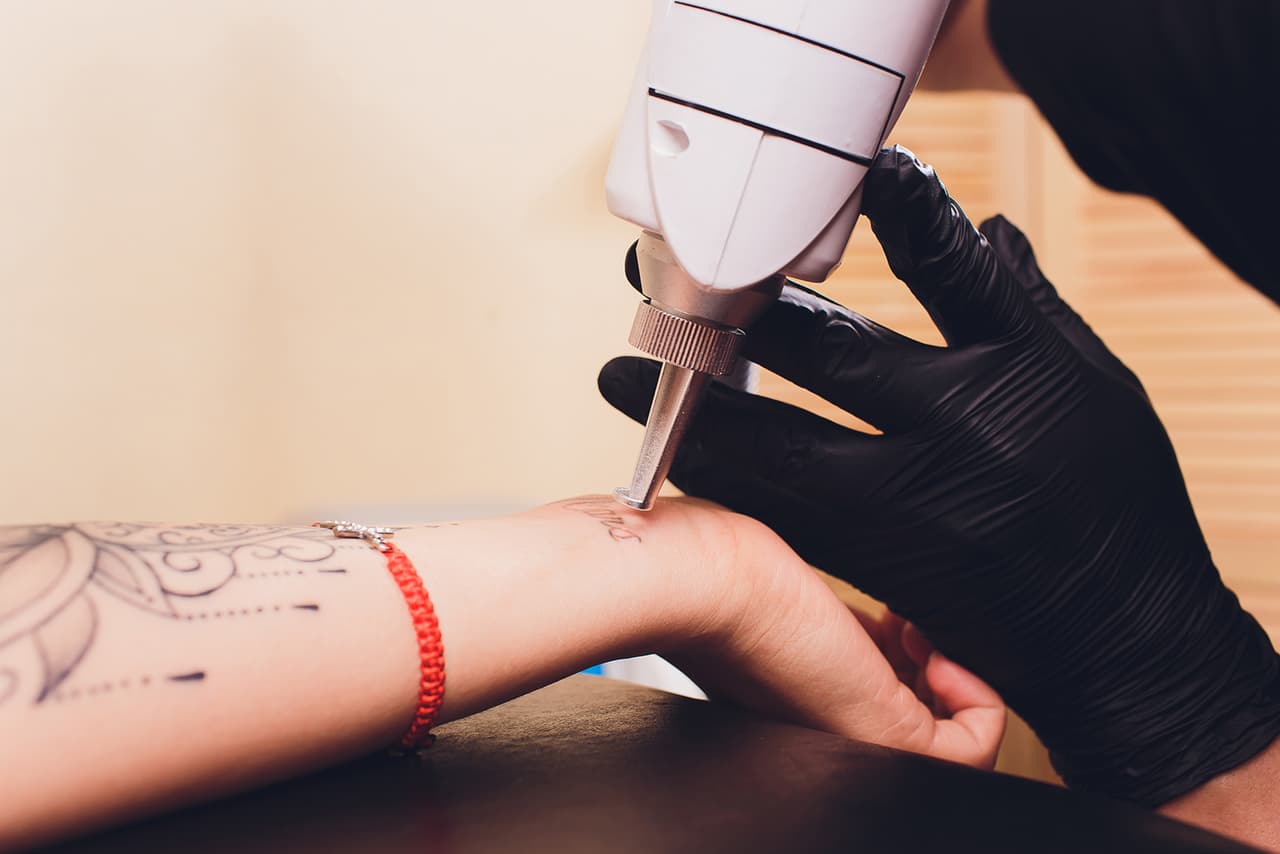 A laser being used to remove a woman's wrist tattoo representing Laser Tattoo removal & Laser Hair removal at Namaste Skincare and Wellness in Henderson, NV.