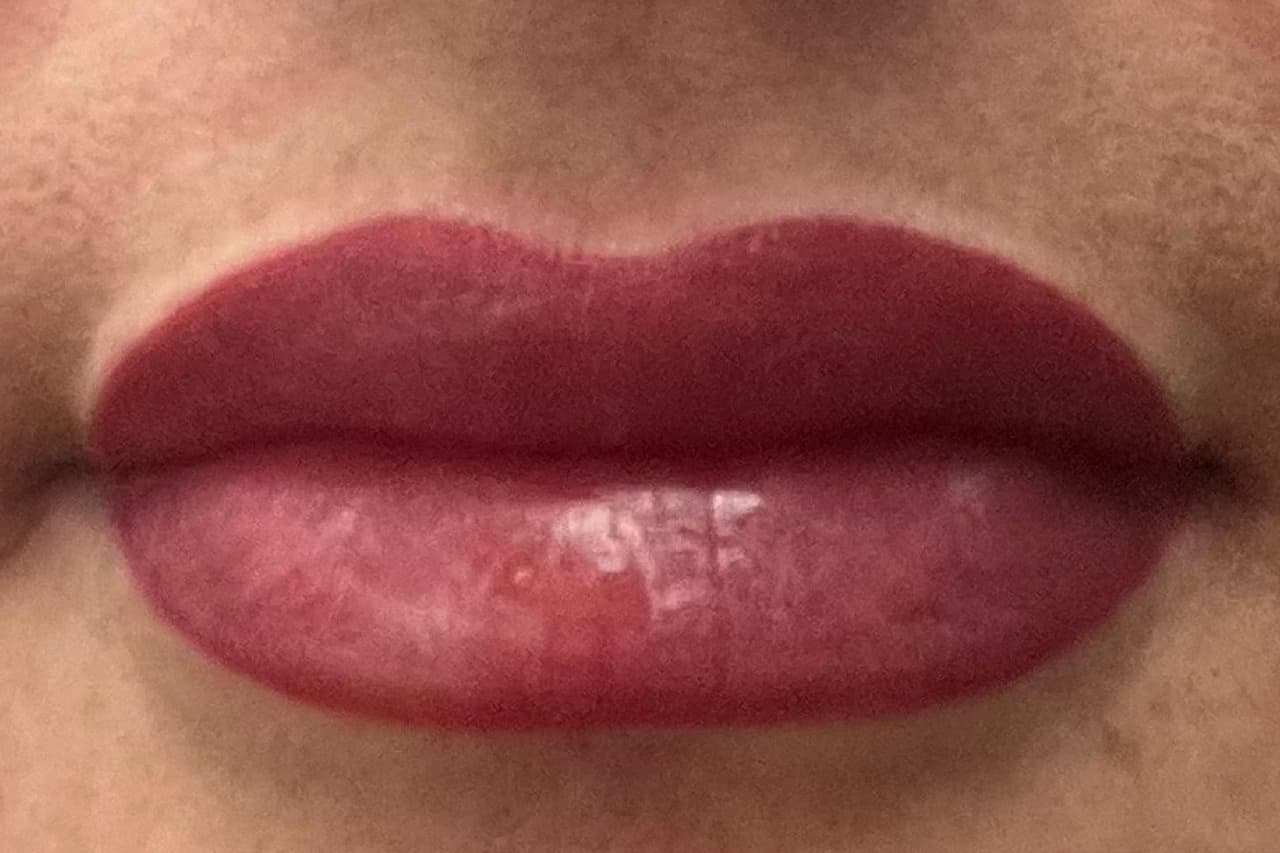 After Microneedling After Microneedling