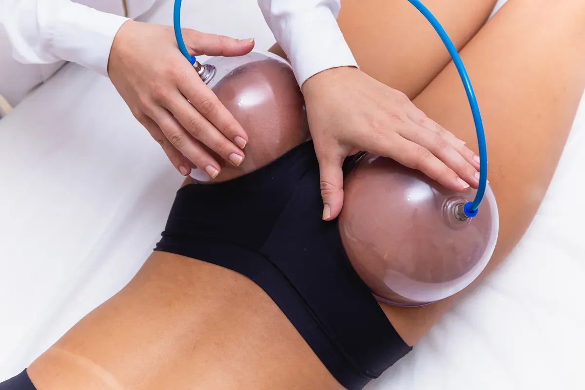 Esthetician performs vacuum cupping on client's buttocks.